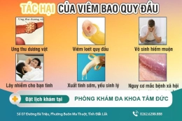 Những điều cần biết về viêm bao quy đâu