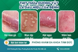 Thịt thừa dương vật - Hiện tượng nam giới cần chú ý