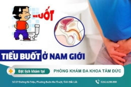 Tiểu buốt ở nam - nguyên nhân và cách chữa trị