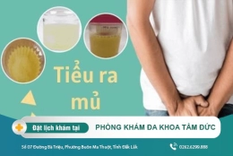 Đi tiểu buốt ra mủ ở nam giới là bệnh gì?