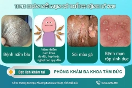 TINH HOÀN NỔI MỤN BẤT THƯỜNG NGUYÊN NHÂN DO ĐÂU?