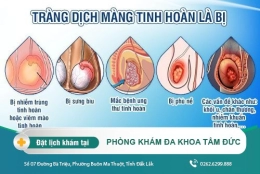 Tinh hoàn có nước - Tràn dịch là biểu hiện bệnh lý gì ? Nguyên nhân và cách điều trị