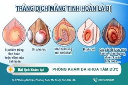 Tràn dịch màng tinh hoàn là bị gì? Nguyên nhân và cách điều trị