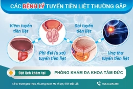 Bệnh tuyến tiền liệt ở nam giới có nguy hiểm không? cách điều trị hiệu quả