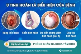 Nam giới bị u tinh hoàn do đâu - Địa chỉ thăm khám tại Đắk Lắk