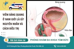 Các nguyên nhân dẫn đến viêm bàng quang nam giới thường mắc phải