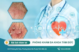 Dương vật bị nổi mụn nước là bệnh gì? Cách điều trị hiệu quả