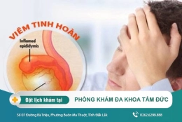 Những điều cần biết về viêm tinh hoàn