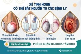 Điểm mặt “thủ phạm” gây xệ tinh hoàn và cách khắc phục hiệu quả