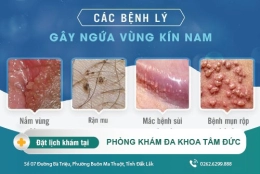 Ngứa vùng kín nam là bệnh gì? Nguyên nhân, triệu chứng và cách điều trị