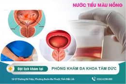 Nước tiểu màu hồng - Nguyên nhân và cách điều trị hiệu quả
