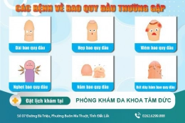 Bao quy đầu là gì? Các bệnh về bao quy đầu thường gặp và cách chữa trị