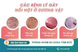 Nổi nốt đỏ ở dương vật - triệu chứng của bệnh lý dương vật