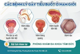 Tiểu buốt ở nam giới - Dấu hiệu của nhiều bệnh lý nguy hiểm