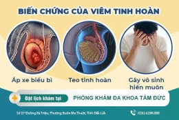 Top những cách điều trị viêm tinh hoàn hiệu quả hiện nay