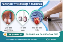Các bệnh lý thường gặp ở tinh hoàn - địa chỉ khám tinh hoàn giỏi