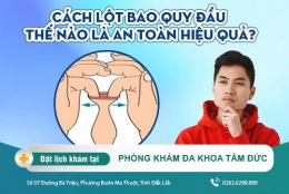 Có nên tự lột bao quy đầu tại nhà? Địa chỉ lột bao quy đầu an toàn hiện nay