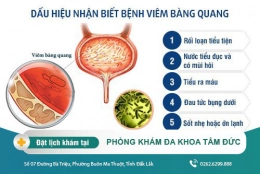Dấu hiệu viêm bàng quang ở nam giới dễ nhận biết