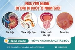 Đi đái bị buốt - Nguyên nhân và cách hỗ trợ điều trị hiệu quả