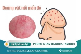 Hiện tượng nổi chấm đỏ ở dương vật