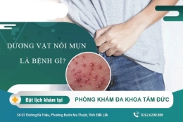 Nổi mụn ở đầu dương vật là bệnh gì? Có nguy hiểm không?