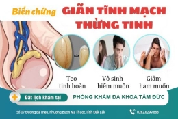 Giãn tĩnh mạch thừng tinh và cách điều trị giãn tĩnh mạch thừng tinh hiệu quả