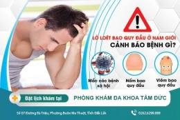 Lở loét bao quy đầu ở nam giới - tác hại và cách điều trị hiệu quả