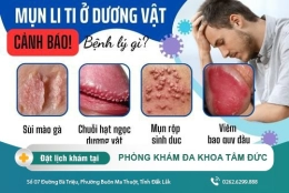 Dương Vật Bị Nổi Mụn Li Ti - Nguyên Nhân Và Cách Điều Trị