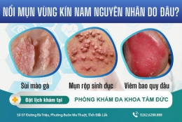 Mụn vùng kín nam - Dấu hiệu bệnh lý nguy hiểm, nam giới chớ nên xem thường
