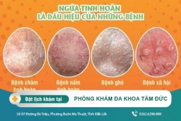 Ngứa tinh hoàn - nguyên nhân và cách khắc phục tình trạng ngứa tinh hoàn ở nam giới