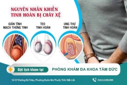 Điểm mặt “thủ phạm” gây xệ tinh hoàn và cách khắc phục hiệu quả