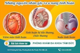 U nang tinh hoàn - Địa chỉ điều trị an toàn hiệu quả tại Đắk Lắk