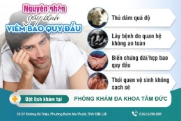 Viêm bao quy đầu - Nguyên nhân và cách điều trị hiệu quả