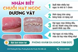 Những điều cần biết về hạt ngọc dương vật