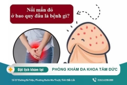 Nổi mẩn đỏ bao quy đầu là bệnh lý gì? Tìm hiểu tại đây nhé!
