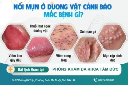 Thân dương vật bị nổi mụn là dấu hiệu bệnh gì? Tìm hiểu ngay tại bài viết