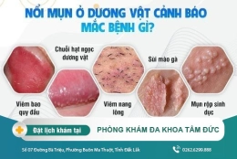 Dương vật nổi mụn: Nguyên nhân, cách điều trị