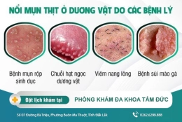 Bị nổi mụn thịt ở dương vật - nguyên nhân và cách điều trị