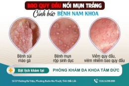 Nổi mụn trắng ở bao quy đầu có nguy hiểm không? Cách điều trị ra sao?