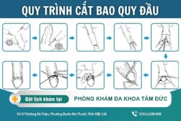 Quy trình cắt bao quy đầu ở nam giới và địa chỉ cắt bao quy đầu uy tín tại Buôn Ma Thuột Đắk Lắk