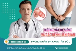 Giải đáp thắc mắc về hiện tượng dương vật bị sưng