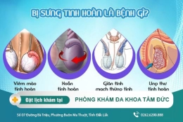 Sưng tinh hoàn là dấu hiệu của bệnh gì và cách điều trị hiệu quả