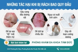 Điều trị rách bao quy đầu hiệu quả tại Phòng Khám Nam Khoa Tâm Đức