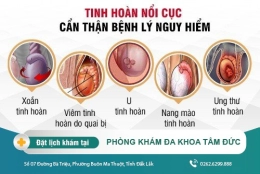 Tinh hoàn nổi cục - Dấu hiệu bệnh nguy hiểm