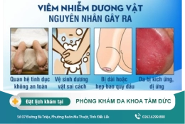 Viêm dương vật cần xử lý như thế nào? Cách chữa viêm dương vật