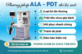Cách trị sùi mào gà tại nhà cho cả nam và nữ - Tìm hiểu ngay về cách điều trị