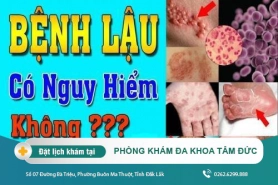 Cách điều trị bệnh lậu tại Đắk Lắk – Nguyên nhân gây nên bệnh lậu là gì?