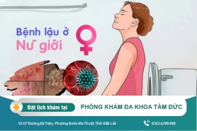Dấu hiệu bệnh lậu ở nữ giới - Cần nắm rõ để chữa trị sớm