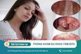 Cách điều trị bệnh lậu tại Đắk Lắk - Dấu hiệu bệnh lậu ở nữ giới là gì?