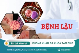 Cách chữa trị bệnh lậu tại Đắk Lắk – Bệnh lậu có lây không?